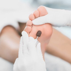 Pedicura profunda (tratamiento de callos)