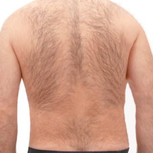 Imagen de hombre referente a depilación de espalda masculina con cera