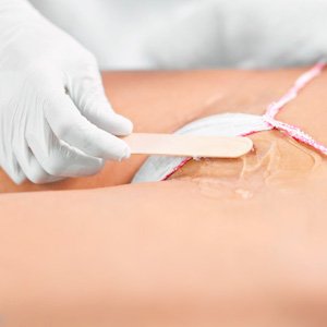 Imagen de mujer referente a depilación de ingles al estilo brazileño