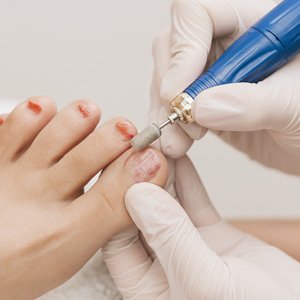 Imagen de pie al que se le hace la reirada de esmaltado semi permanente