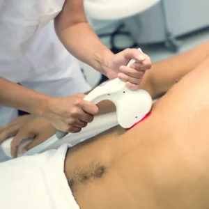 Depilación Láser Diodo Hombre